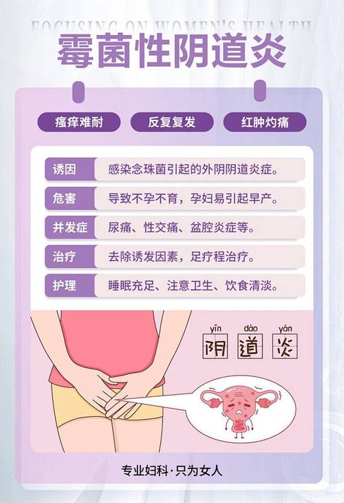 孕期霉菌性阴道炎怎么办？-第1张图片-中州医学会