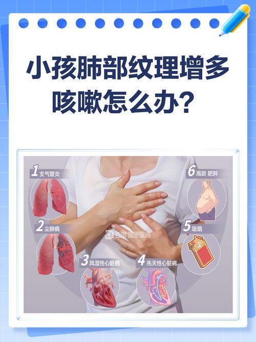 新生儿两肺纹理增多是病吗？-第1张图片-中州医学会