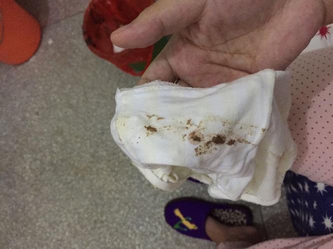 怀孕褐色分泌物正常吗？-第1张图片-中州医学会