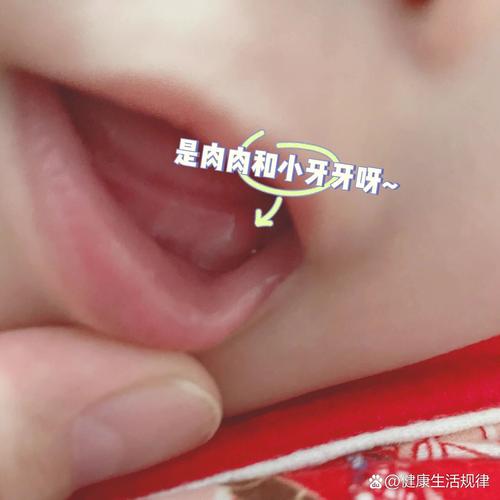 儿童牙龈凸起肉疙瘩是何问题？-第3张图片-中州医学会