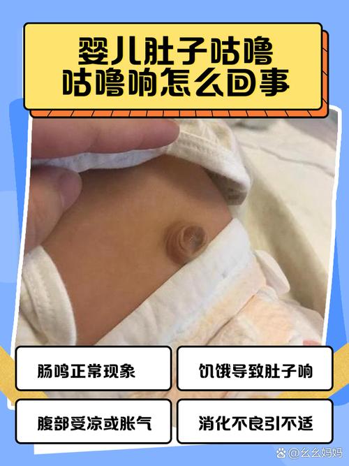 新生儿肚子咕噜响是消化问题吗?-第2张图片-中州医学会 新生儿肚子咕噜响是消化问题吗?-第2张图片-中州医学会