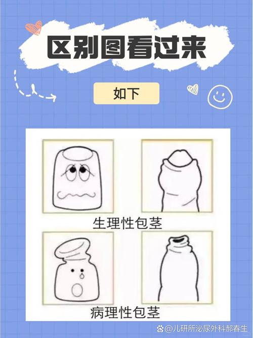 8岁儿童如何判断是否包茎？-第3张图片-中州医学会