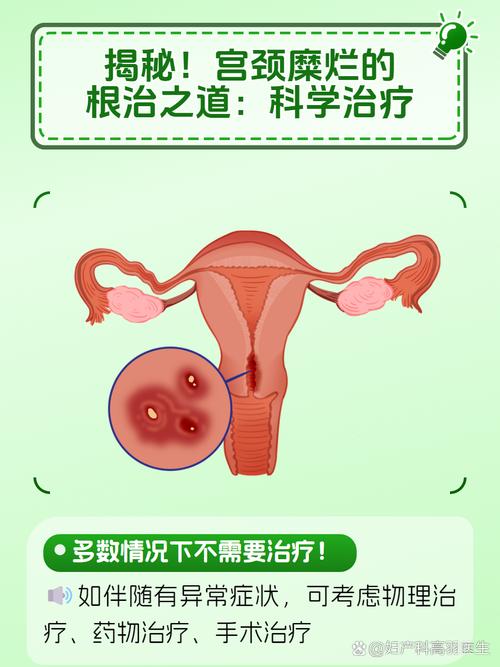 孕期宫颈糜烂怎么办？-第3张图片-中州医学会