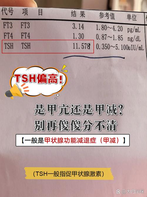 孕期促甲状腺素偏高怎么办？-第3张图片-中州医学会