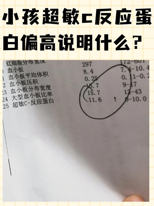 新生儿C反应蛋白高是何原因？-第1张图片-中州医学会