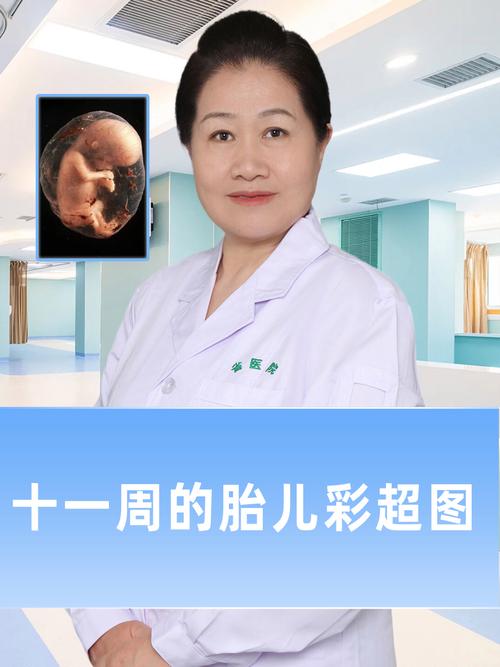 孕期彩超会影响胎儿吗？-第3张图片-中州医学会