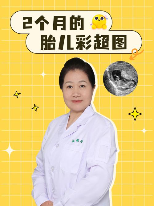 孕期彩超会影响胎儿吗？-第2张图片-中州医学会
