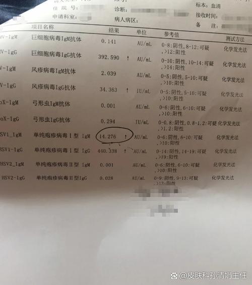 新生儿HSV-IgG阳性意味着感染吗？-第3张图片-中州医学会