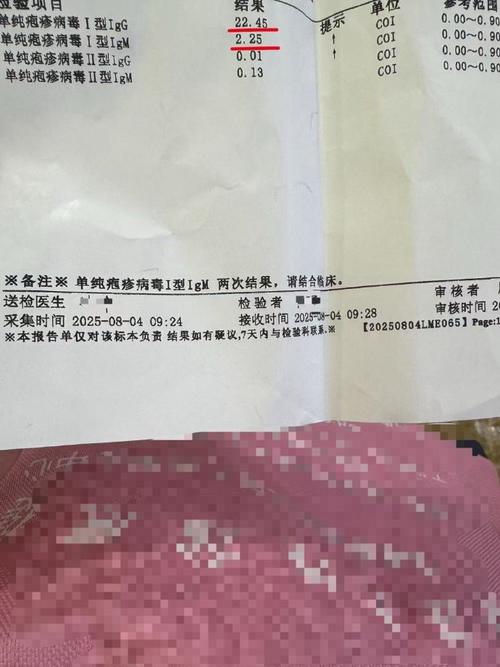 新生儿HSV-IgG阳性意味着感染吗？-第1张图片-中州医学会