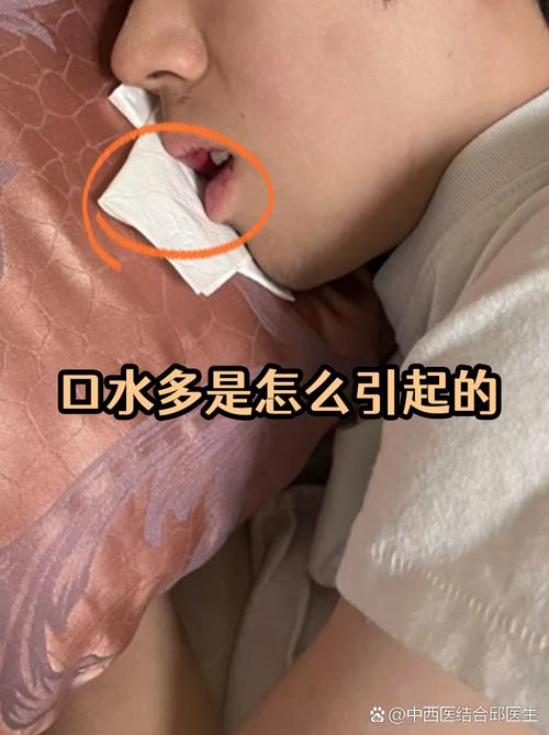 孕期口水多，是正常现象吗？-第3张图片-中州医学会