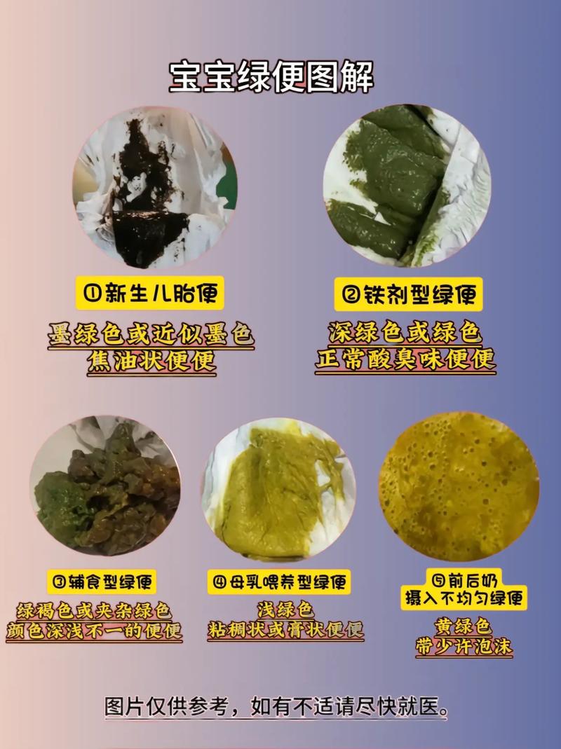 新生儿吃奶就拉屎是正常吗？-第2张图片-中州医学会