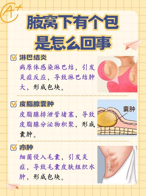 孕期腋下淋巴结肿大要紧吗？-第1张图片-中州医学会