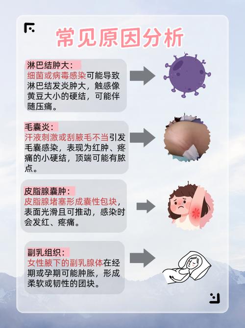 孕期腋下淋巴结肿大要紧吗？-第2张图片-中州医学会