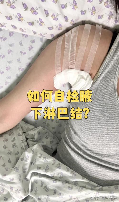 孕期腋下淋巴结肿大要紧吗？-第3张图片-中州医学会