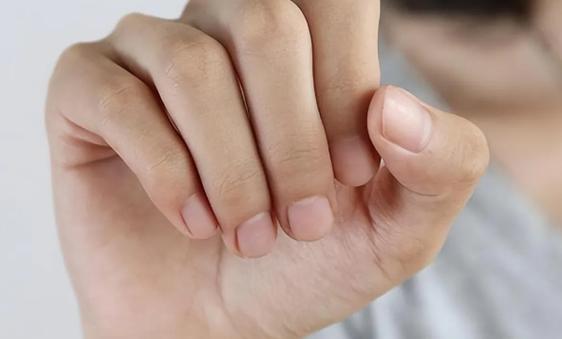 儿童指甲竖纹是缺营养还是生病了？-第2张图片-中州医学会