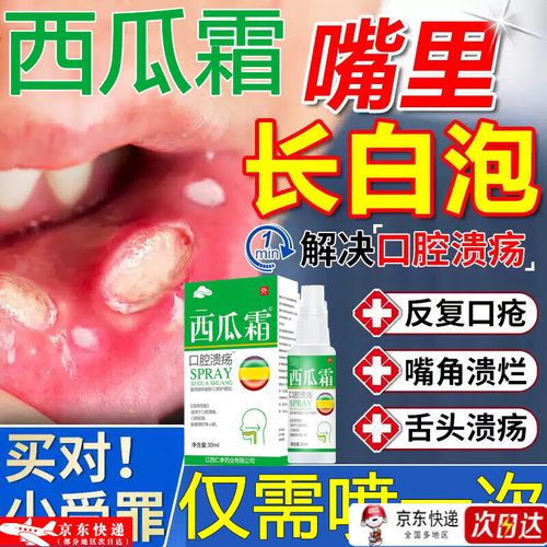 儿童口腔溃疡喷西瓜霜有用吗？-第3张图片-中州医学会