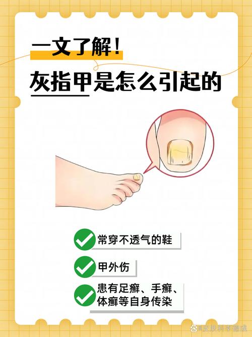 备孕期能治灰指甲吗？药伤胎儿怎么办？-第2张图片-中州医学会