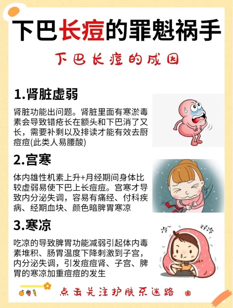 孕期下巴长痘是激素变化还是其他原因？-第2张图片-中州医学会