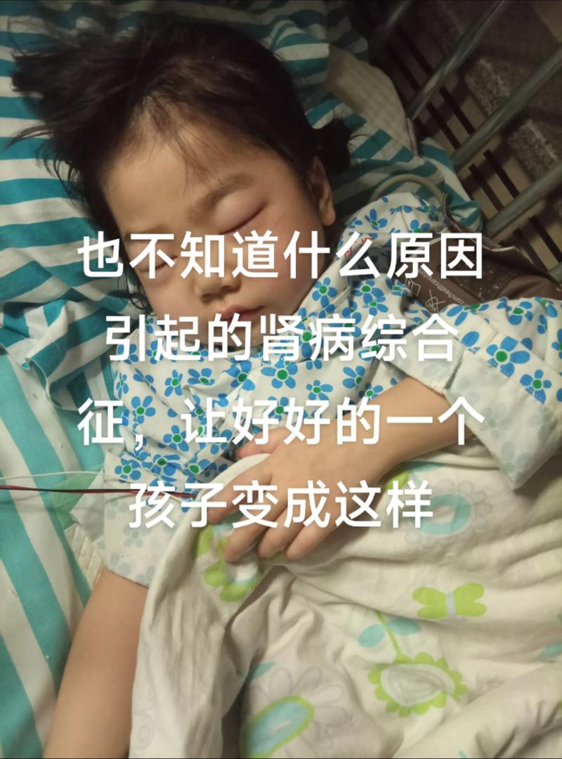 儿童肾病综合症能彻底治愈吗-第2张图片-郑州医学网