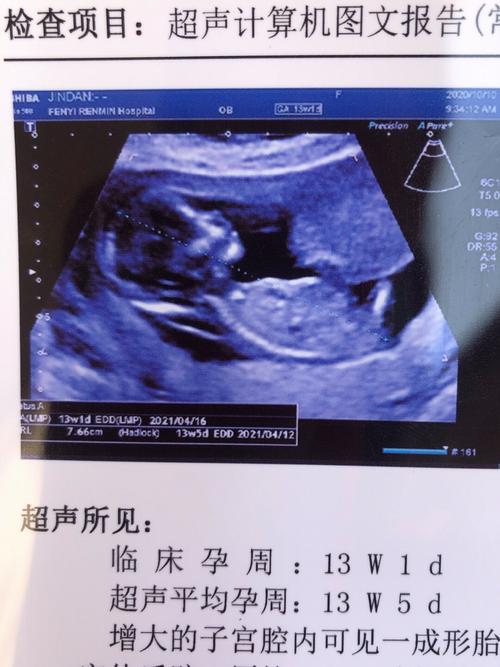 孕期13周NT检查是啥？-第1张图片-中州医学会