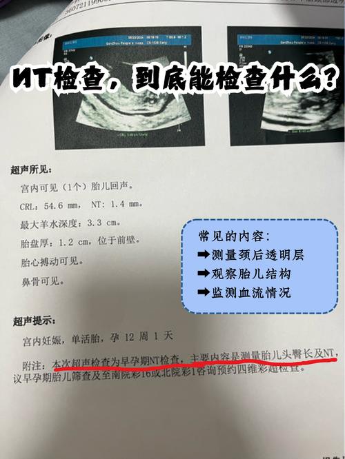 孕期13周NT检查是啥？-第2张图片-中州医学会