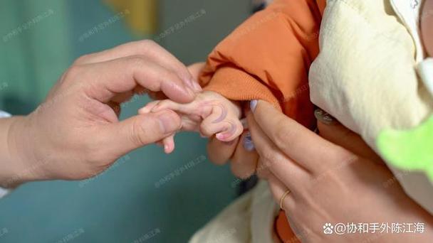 儿童全麻手术会影响智力发育吗？-第1张图片-中州医学会