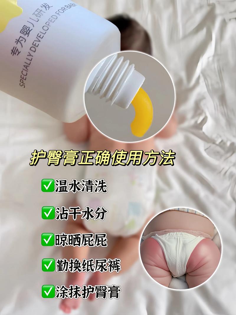 新生儿红屁股能用爽身粉吗？-第3张图片-中州医学会