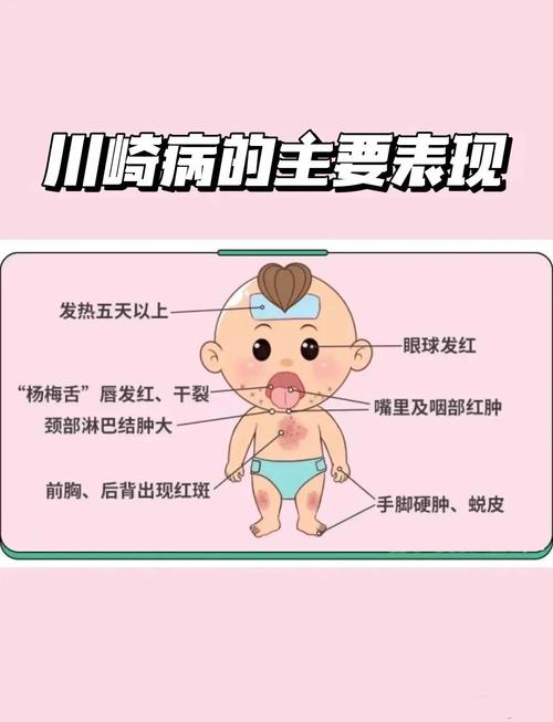 儿童心脏病早期症状有哪些？-第3张图片-中州医学会