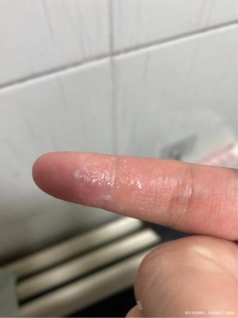 怀孕白带啥样？异常信号咋辨别？-第3张图片-中州医学会