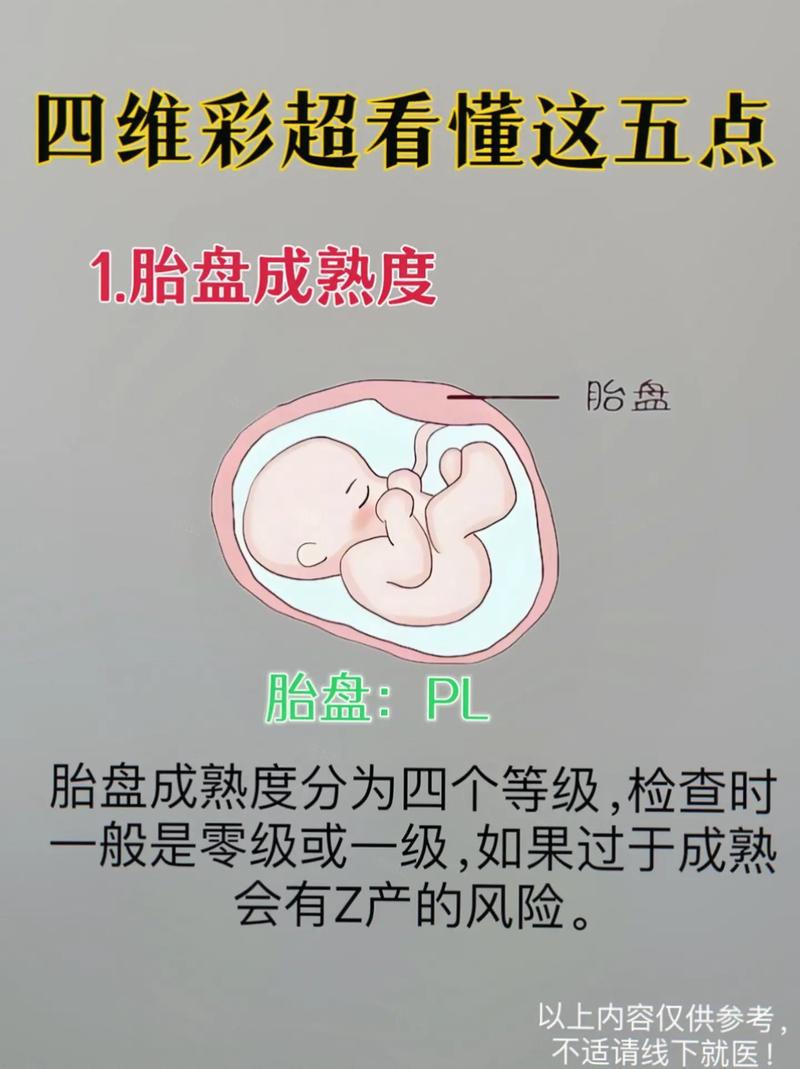 孕期四维彩超最佳时间何时做？-第2张图片-中州医学会