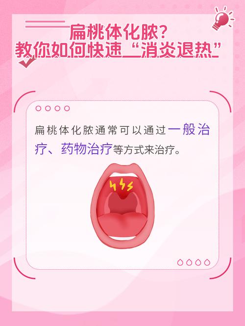 备孕期间扁桃体发炎怎么办-第2张图片-中州医学会