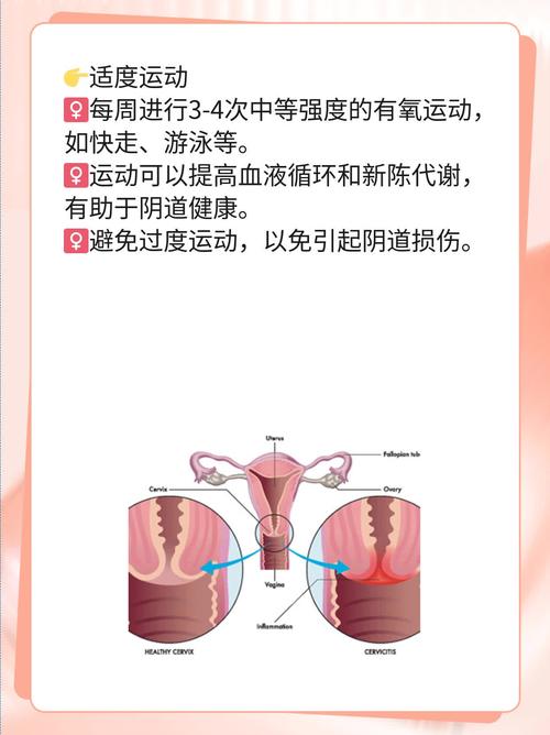 孕期阴道出血是危险信号吗？-第1张图片-中州医学会