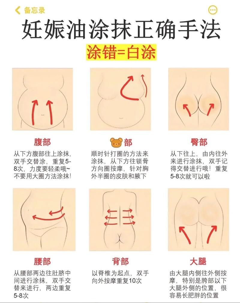 孕期防妊娠纹，抹什么最有效？-第2张图片-中州医学会