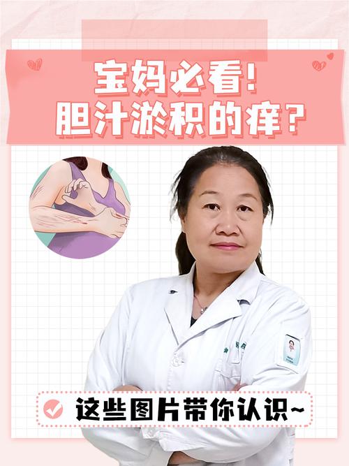 孕期身上痒是何原因？-第3张图片-中州医学会