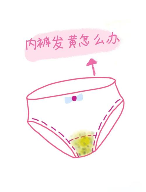 孕期内裤发黄是何原因？-第2张图片-中州医学会