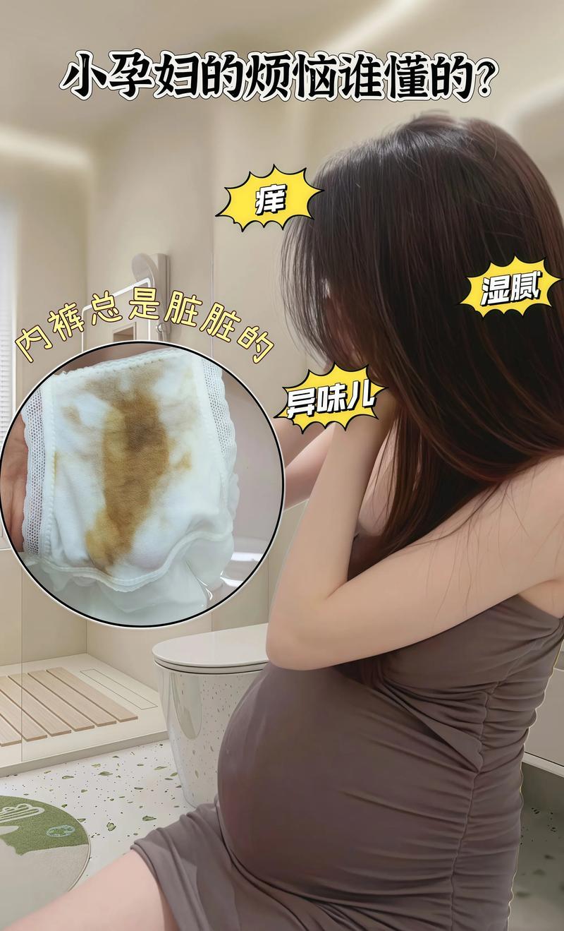 孕期内裤发黄是何原因？-第1张图片-中州医学会