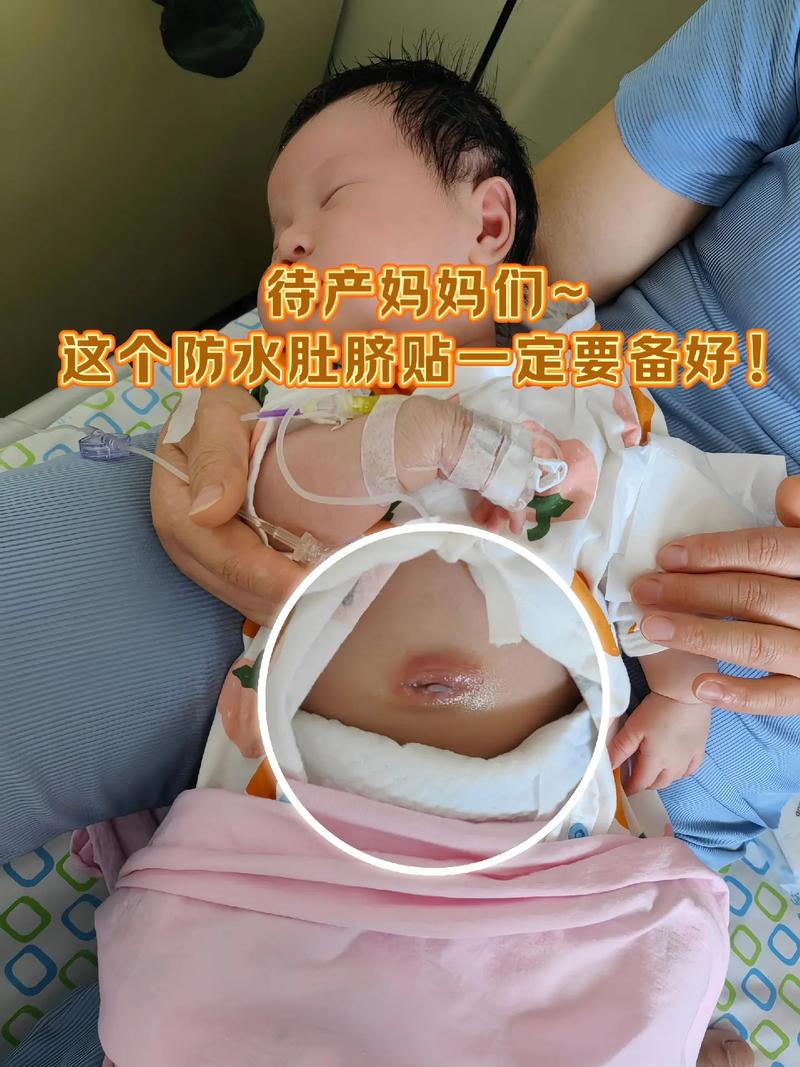 新生儿肚脐脱落有点血怎么办？-第2张图片-中州医学会