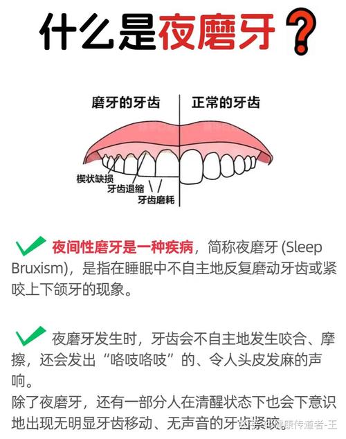 儿童夜间磨牙，是身体在发出什么信号？-第3张图片-中州医学会
