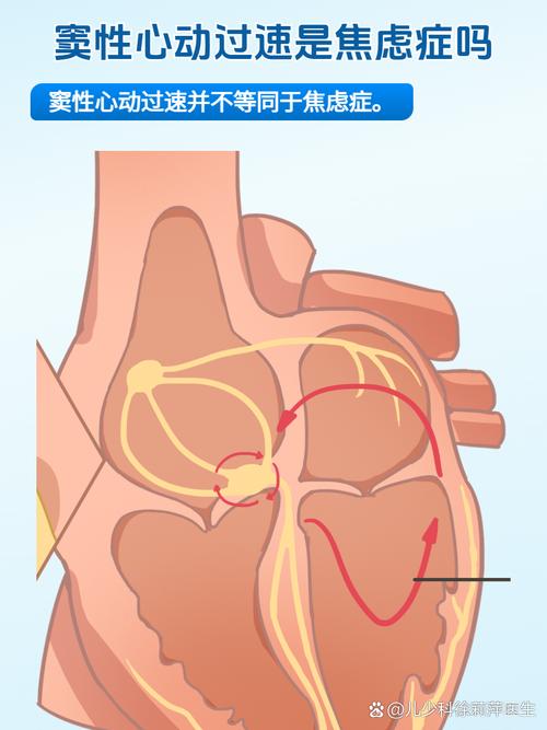儿童窦性心动过速是什么病?-第2张图片-中州医学会 儿童窦性心动过速是什么病?-第2张图片-中州医学会