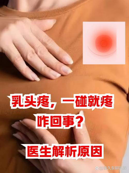 孕期乳头疼是正常反应吗？-第2张图片-中州医学会