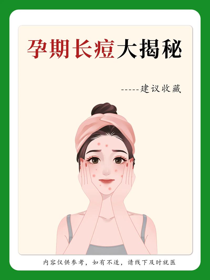 孕期长痘怎么办？-第1张图片-中州医学会
