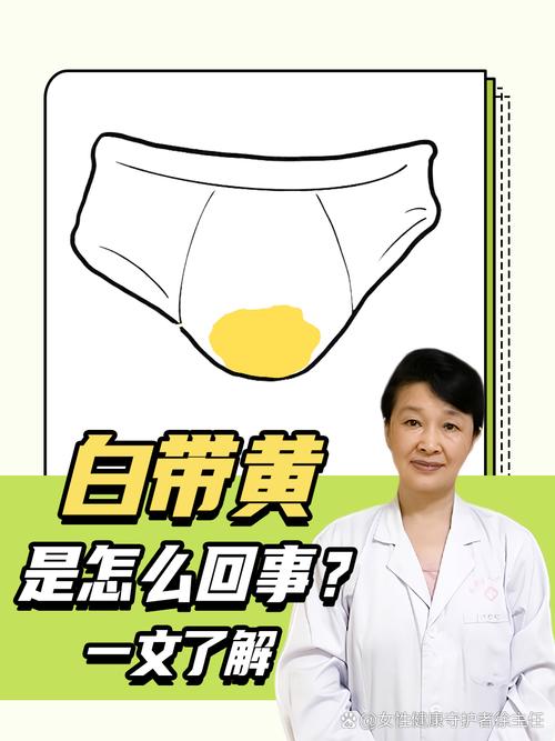 怀孕流黄水是正常现象吗？-第1张图片-中州医学会