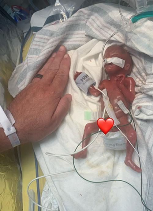 孕期五个月宝宝发育标准图有哪些关键指标？-第3张图片-中州医学会