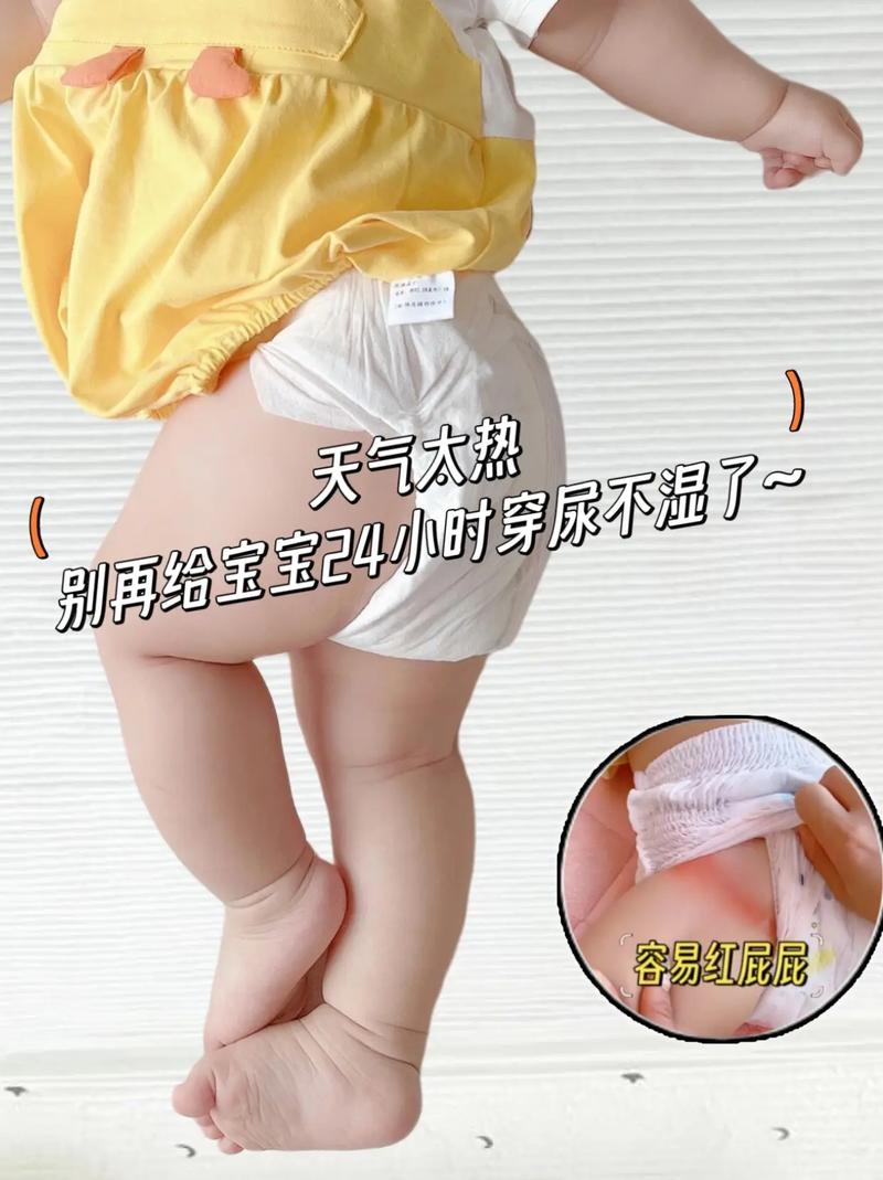 冬天新生儿尿布尿不湿怎么选？-第2张图片-中州医学会
