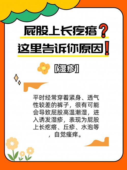孕期屁股长痘痘是激素还是卫生问题？-第1张图片-中州医学会