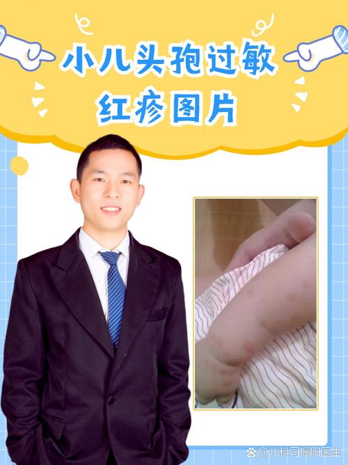 儿童出疹子症状图片怎么辨别？治疗要注意什么？-第3张图片-中州医学会