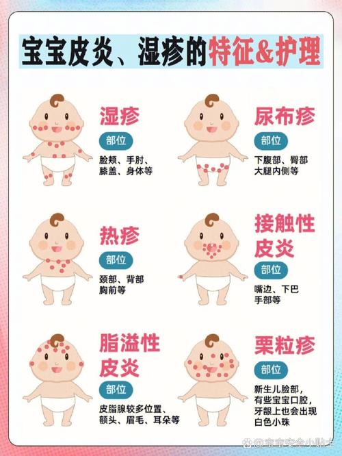 儿童出疹子症状图片怎么辨别？治疗要注意什么？-第2张图片-中州医学会