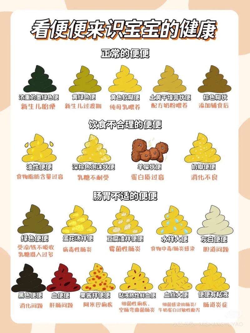 新生儿一天拉十次大便正常吗-第1张图片-中州医学会