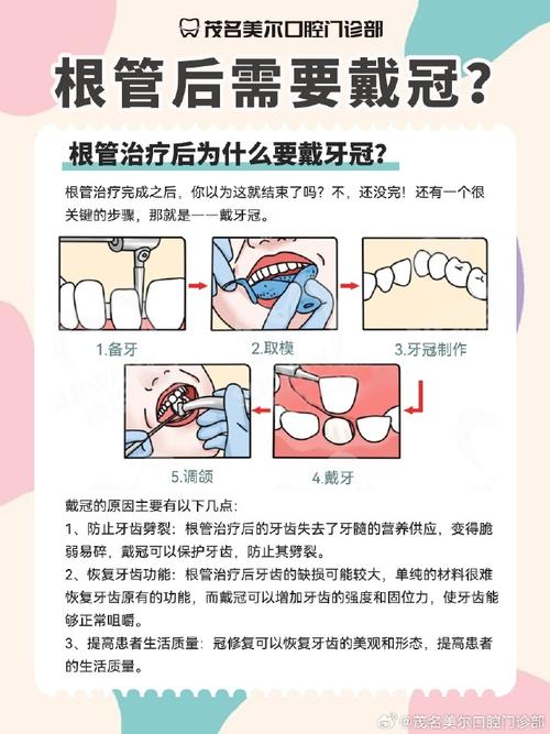 儿童牙齿根管治疗一颗要花多少钱？-第2张图片-中州医学会