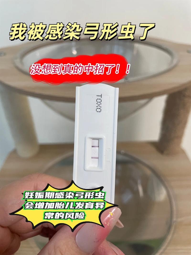 孕期感染弓形虫有哪些症状？-第3张图片-中州医学会